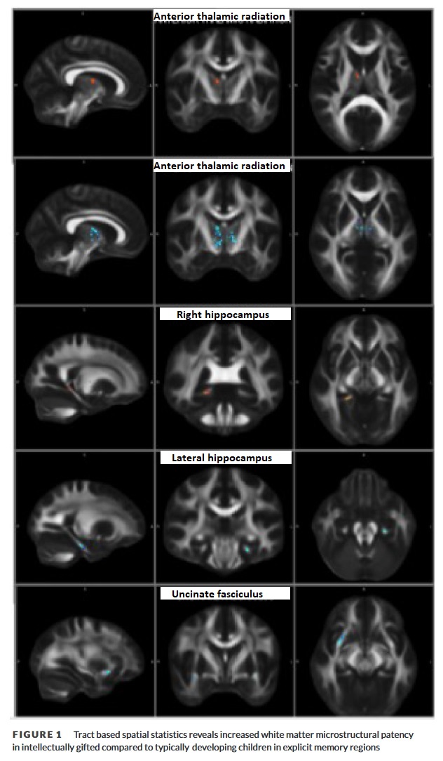 Memory Figure 1