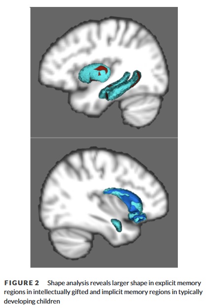 Memory Figure 2